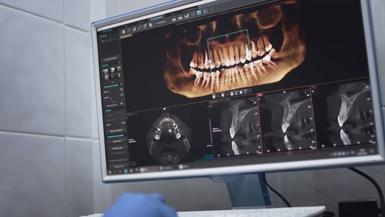 Best Dental X-Rays and Imaging  in Bystrom, CA